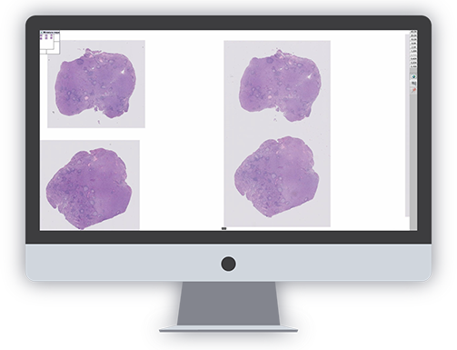 Imagen de patología